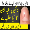 Nails Par Chand Ka Nishan kis waja say hoty han