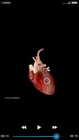 Cardiology-Animated Dictionary capture d'écran 3
