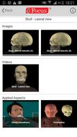 Head and Neck- Digital Anatomy capture d'écran 2