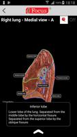 Lungs capture d'écran 3