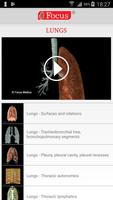 Lungs capture d'écran 1