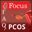 FAQs in PCOS