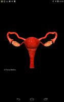 FAQs in PCOS تصوير الشاشة 2