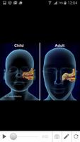 2 Schermata Otitis Media