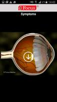 Glaucoma تصوير الشاشة 2