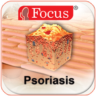 ikon Psoriasis