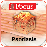 Psoriasis icon