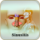 Sinusitis ikona