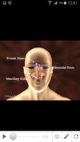 Sinusitis screenshot 2