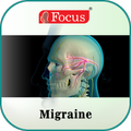Migraine-An Overview