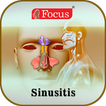 Sinusitis