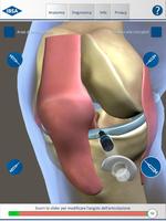 KneeApp اسکرین شاٹ 1