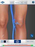 KneeApp screenshot 2