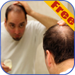 Hair loss Prevention Tips