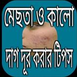 মেছতা ও কালো দাগ দূর করার টিপস