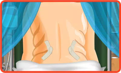 Liposuction Surgery Doctor APK download