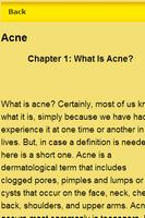 Remove Acne Tips ảnh chụp màn hình 1