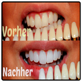 Weiße Zähne Tipps 2017
