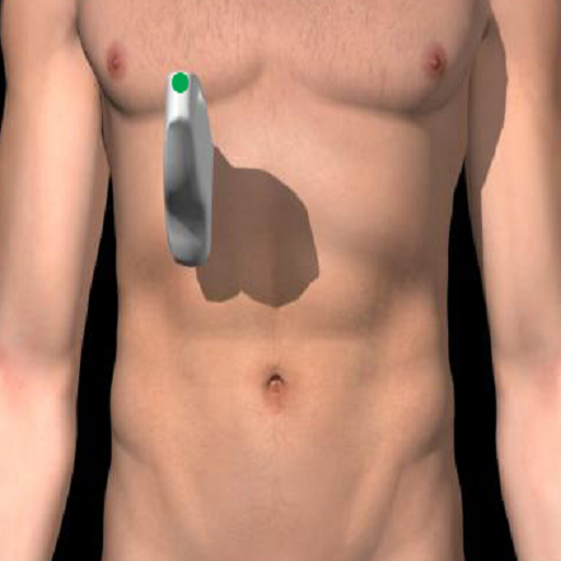 ULTRASOUND GALLBLADDER AND PHATOLOGY
