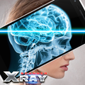 Xray Scan Prank
