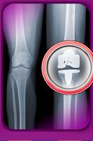 Knee Surgery Doctor Simulator syot layar 3