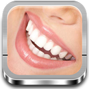 Blanqueamiento dental,Guía APK