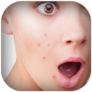 Get Rid From Pimple APK