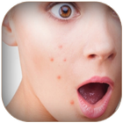 Get Rid From Pimple icône