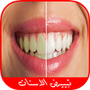 خلطات تبييض الأسنان طبيعيا APK