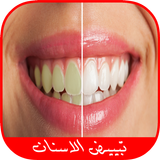 خلطات تبييض الأسنان طبيعيا أيقونة