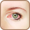 How to remove red eyes APK