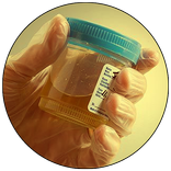 Analisi delle Urine
