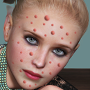 Fashion Model Zit Popper 2 APK