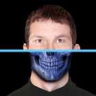 XRay Camera For Head Zeichen