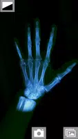 Super XRay Camera screenshot 1
