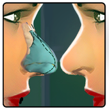 Nose Surgery ER Simulator Lite icon