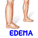 Edema swelling Symptoms APK