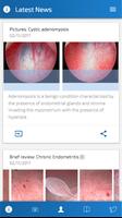 Hysteroscopy News โปสเตอร์