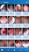 Hysteroscopy News स्क्रीनशॉट 1