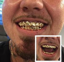 Gold Teeth Editor पोस्टर
