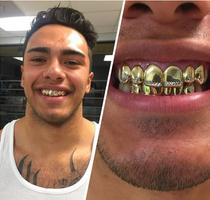 Gold Teeth Editor स्क्रीनशॉट 1