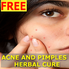 Pimple and Acne Removal Remedies : Free icon