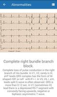 ECG  Interpretation and Tests. capture d'écran 2