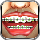 Braces Surgery Dentist Game APK