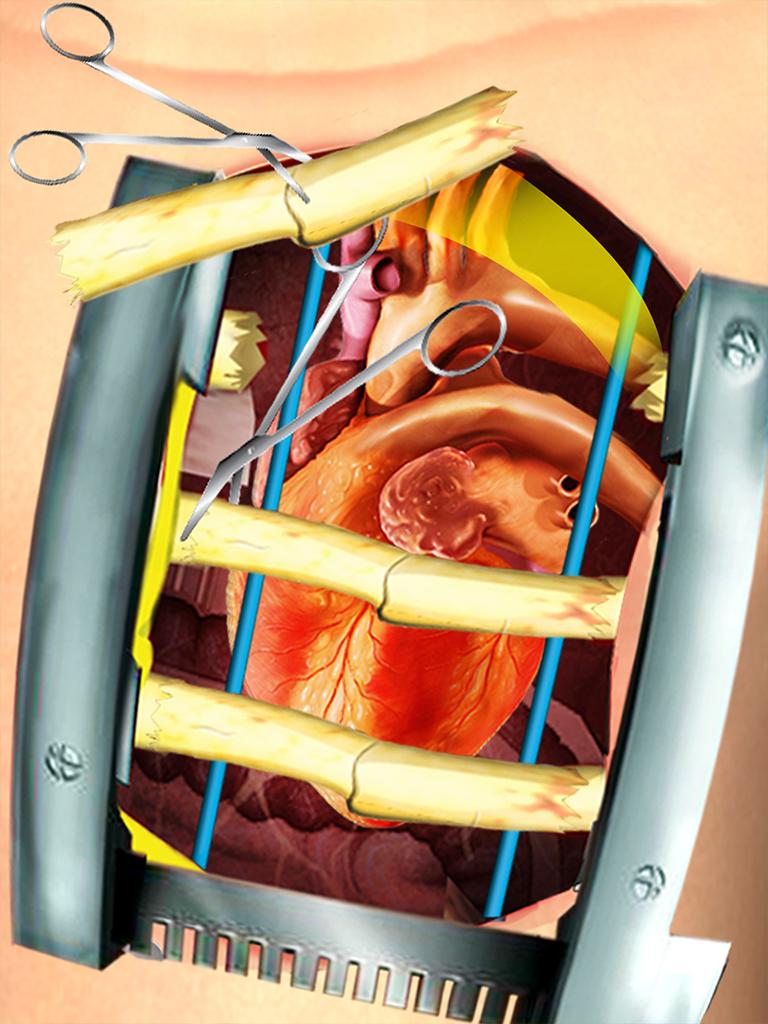 Open Heart Surgery Simulator for Android APK Download