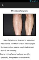 Thrombosis Symptoms capture d'écran 2