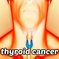 Thyroid Cancer Symptoms постер