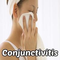 Conjunctivitis or Pink Eye Affiche