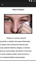 Conjunctivitis or Pink Eye capture d'écran 2