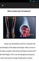 Deep Vein Thrombosis screenshot 2